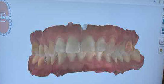 Clinica odontologia Mari Carmen perez clinica dental Badajoz, extremadura